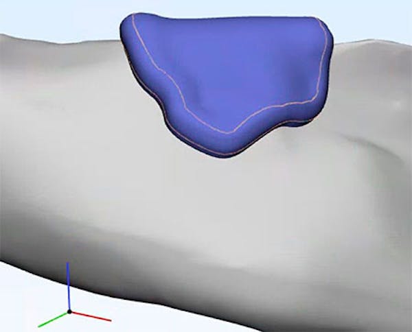 OSTEOCAR3D: Il bioprinting offre una nuova metodologia per produrre prodotti sanitari personalizzati