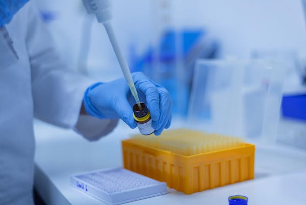 Diagnosi precoce del Parkinson grazie all’Intelligenza Artificiale: i risultati di uno studio dell’Univeristà di Bari