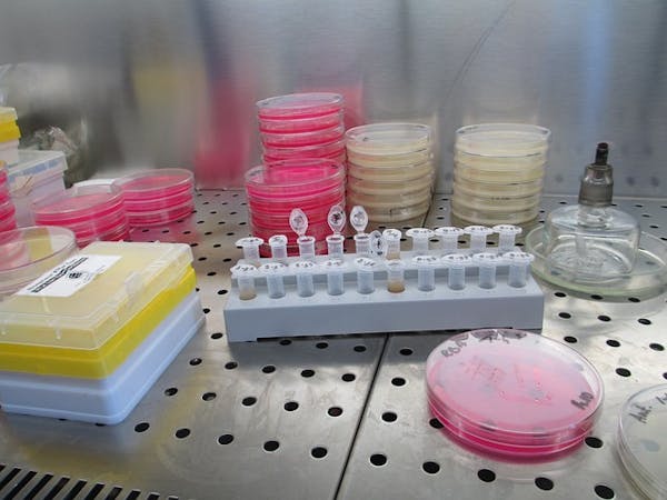 Alzheimer: secondo uno studio cinese si potrà diagnosticare attraverso l'analisi delle urine
