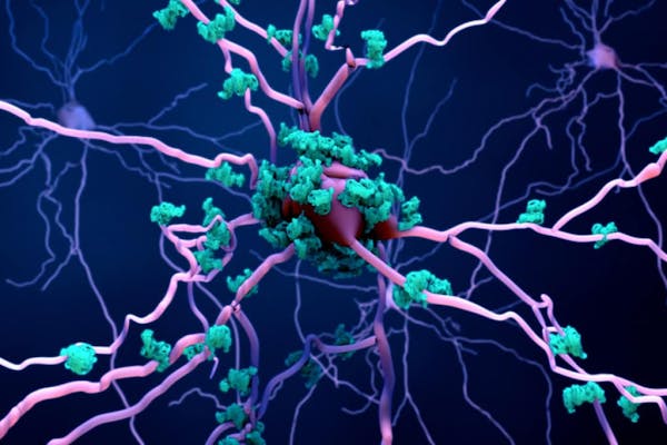 Alzheimer: un neurone bionico per la lotta alla demenza negli anziani