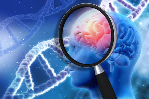 Alzheimer ed Intelligenza Artificiale: lo studio del modello in grado di effettuare la diagnosi precoce della malattia