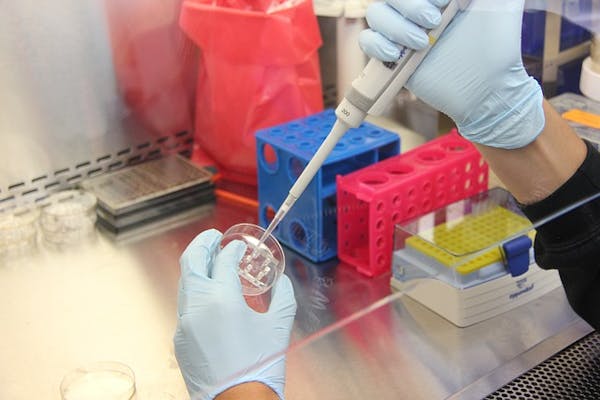 La mutazione di due geni sarebbe tra le possibili cause dell'Alzheimer