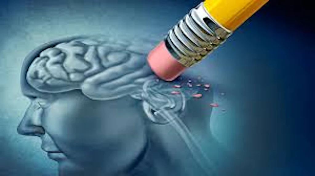 Alzheimer: dagli USA una nuova possibile terapia