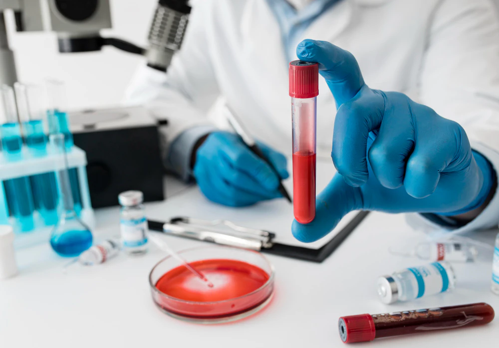 Università di Bologna: scoperta innovativa per la diagnosi precoce di Parkinson e demenza