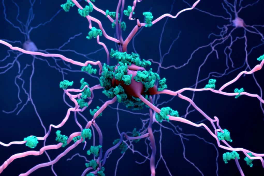 Alzheimer: un neurone bionico per la lotta alla demenza negli anziani